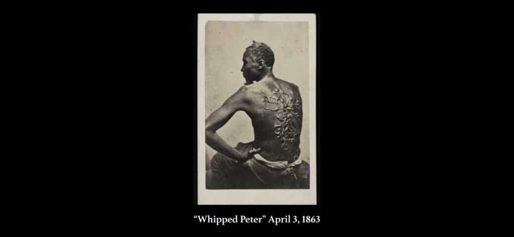Whipped Peter, o homem que teve suas costas brutalmente flageladas. Sua história inspirou uma importante revolução