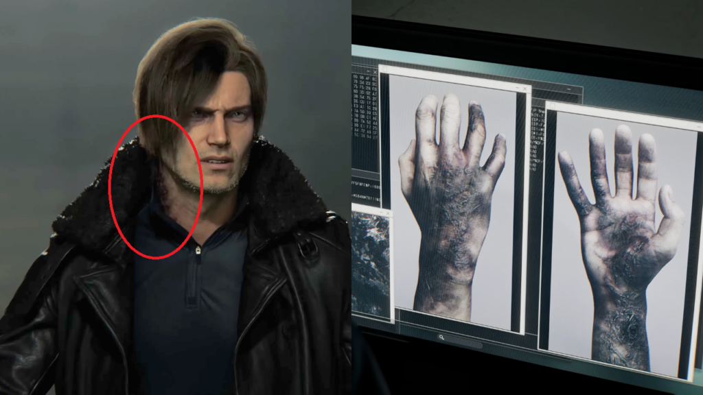 Leon S. Kenndy será infectado?